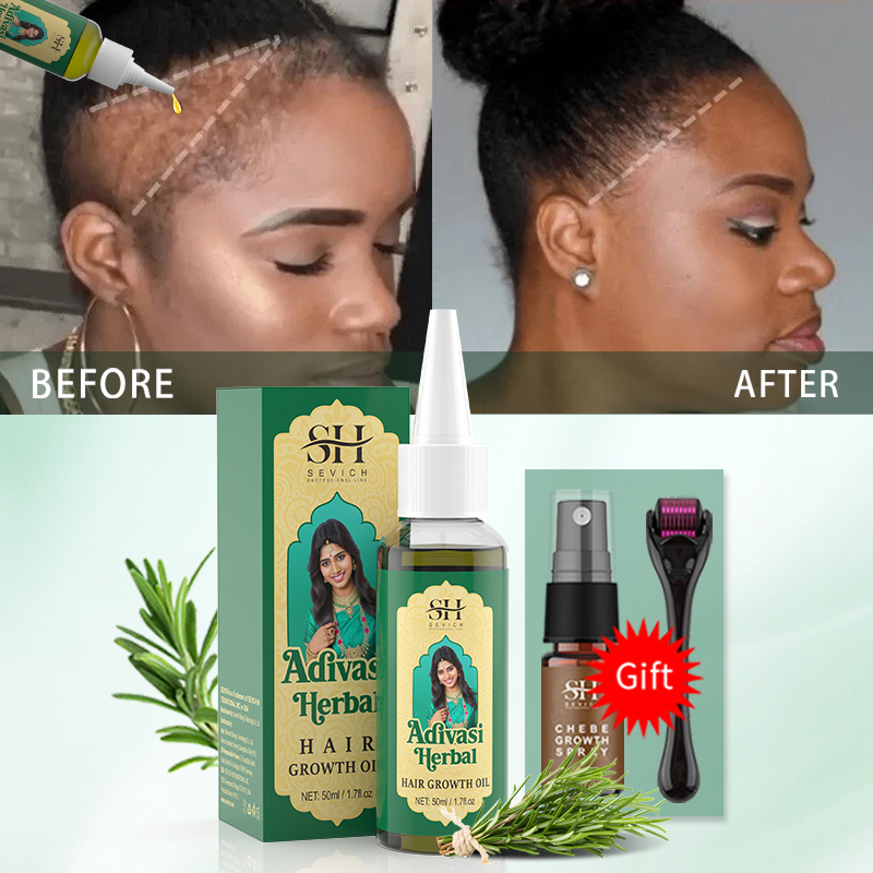 Ayurvedic Hair Growth Oil Indi - Ingrown Hair Serum review and price