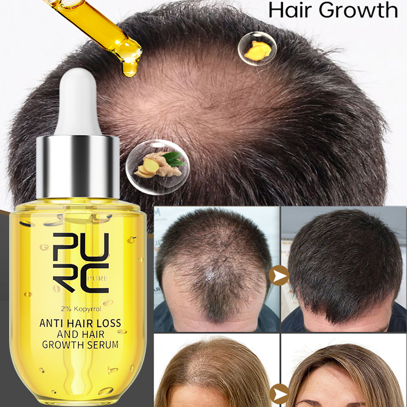 PURC Hair Growth Serum for Men - Ingrown Hair Serum review and price