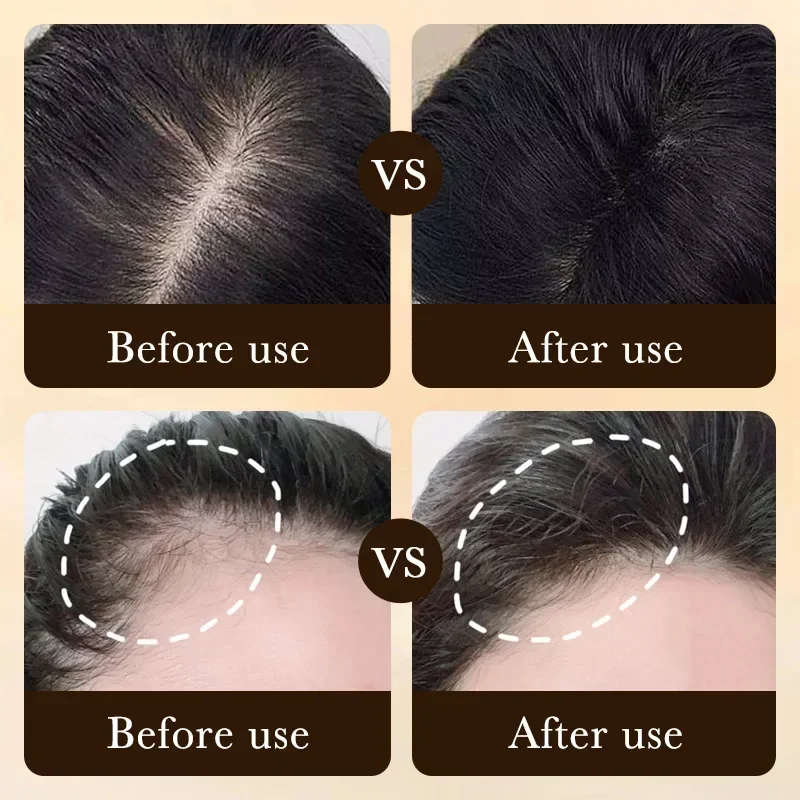 Biotin fast Hair Growth oil Pr - Ingrown Hair Serum review and price
