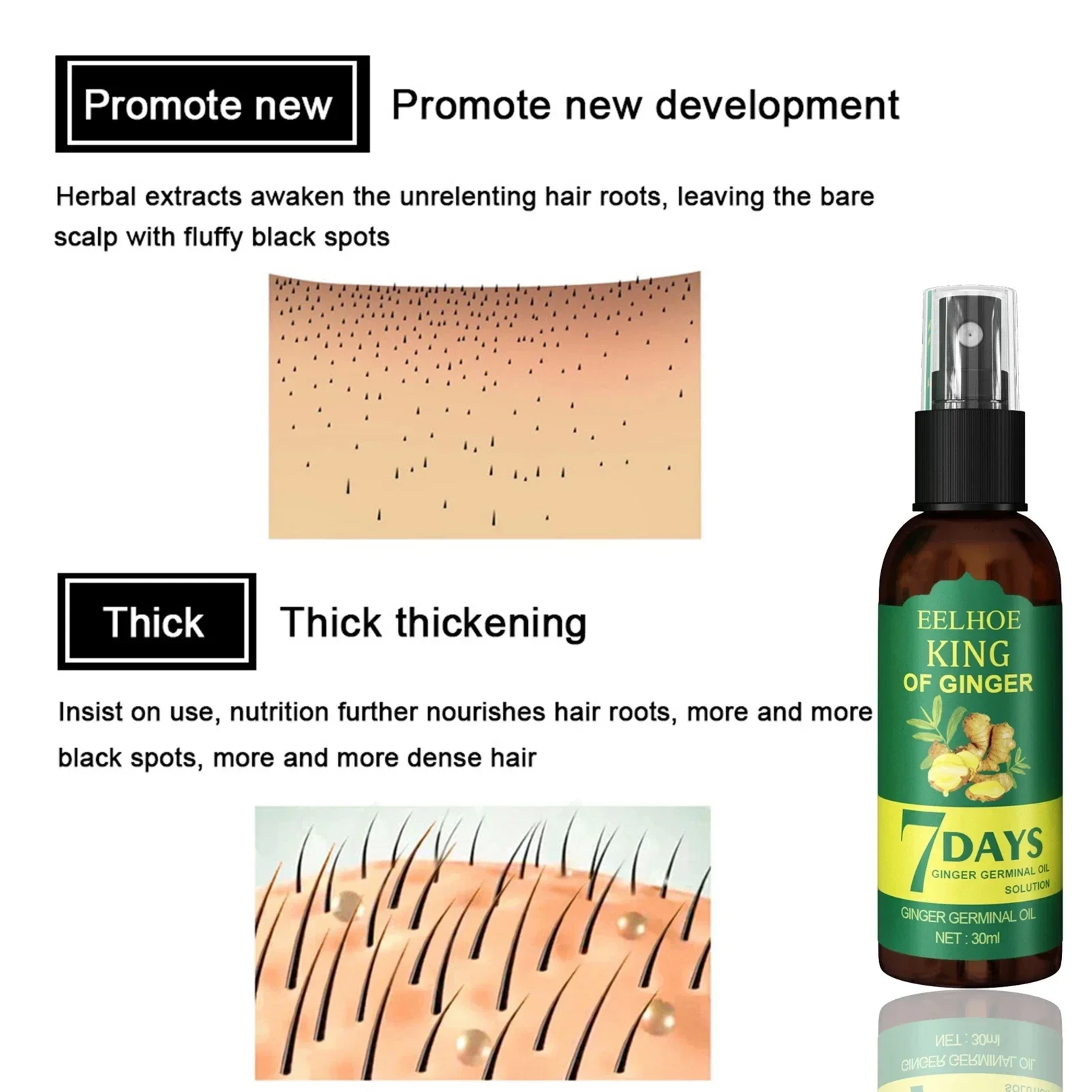 2024 Ginger Hair Growth Serum  - Ingrown Hair Serum review and price