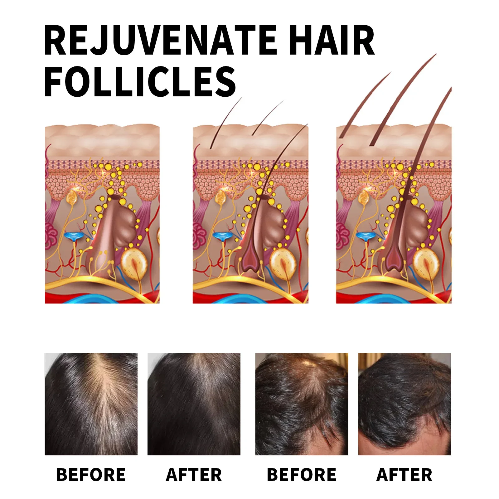Ginger Hair Growth Products Fa - Ingrown Hair Serum review and price