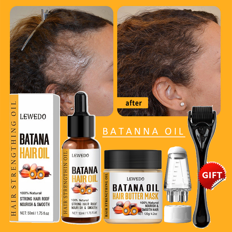 Batana Oil Hair Growth Kit Tra - Ingrown Hair Serum review and price