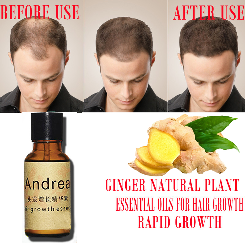 2/5/10Pcs Andrea Hair Growth S - Ingrown Hair Serum review and price