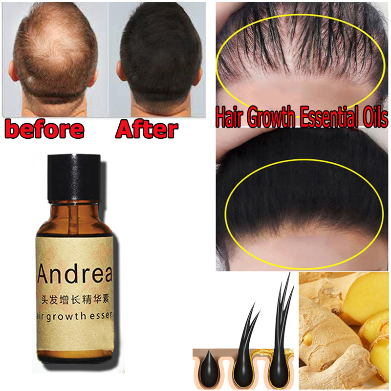 2/5/10Pcs Andrea Hair Growth S - Ingrown Hair Serum review and price